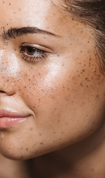 Young Woman with Freckles